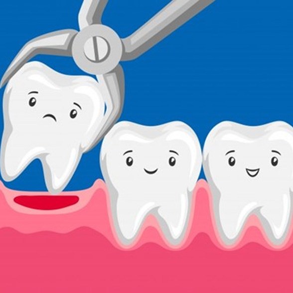 a cartoon representing a tooth being extracted