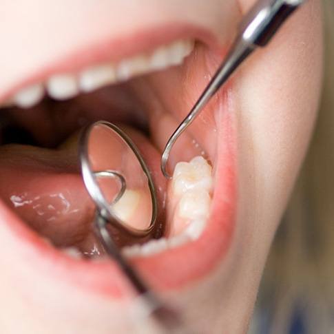 Pediatric dentist in Worcester examining child's teeth