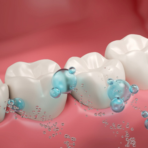 a 3D illustration showing fluoride on teeth