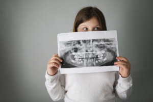 a child holding a dental X-ray image